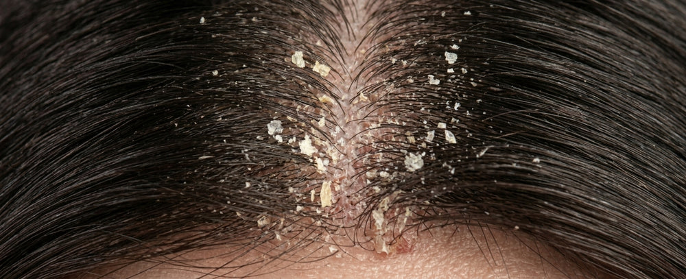Before comparison image