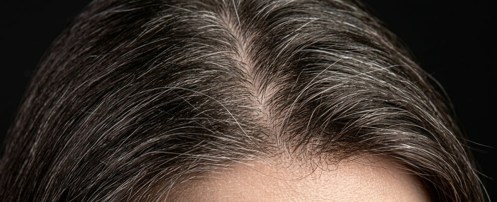 Before comparison image